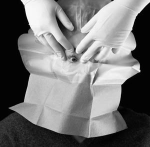 3M STERI-DRAPE OPHTHALMIC SURGICAL DRAPES, 1022