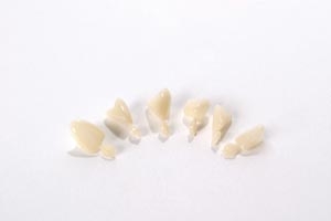 3M Polycarbonate Crowns 300 Upper Right Cuspid 5Bx