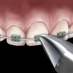 Slim Micro Cutter, Hu-Friedy, 678-500