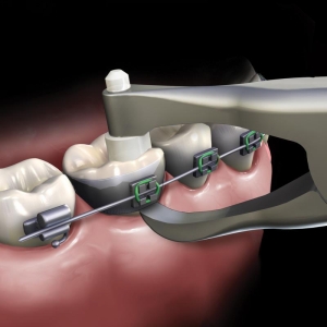 Pliers Slim Line Band Remover