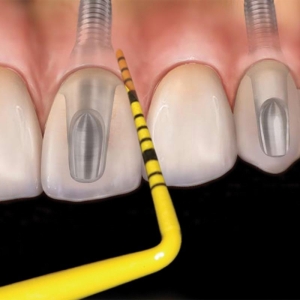 11 Colorvue Probe Kit #6 Satin Steel, 2 handles and 12 tips, Hu-Friedy, PCV11KIT12