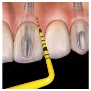 Colorvue Probe 3-6-9-12 6/Pk #6 Handle