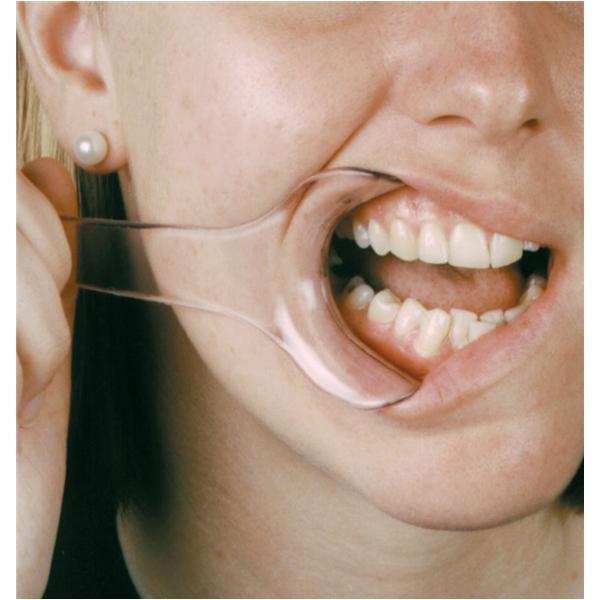 Mirahold Lip & Cheek Retractor Child Clear 2/Pk, Hager Worldwide, 605451